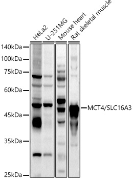 MCT4/SLC16A3 Rabbit Polyclonal Antibody