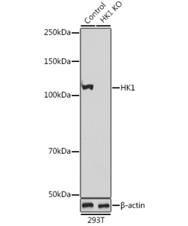HK1 Rabbit Polyclonal Antibody [KO Validated]