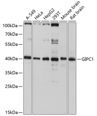 GIPC1 Rabbit Polyclonal Antibody