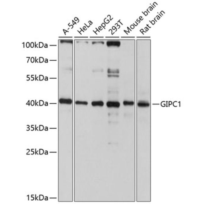 GIPC1 Rabbit Polyclonal Antibody