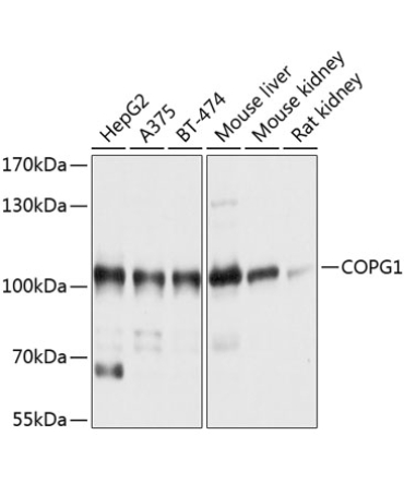 COPG1 Rabbit Polyclonal Antibody