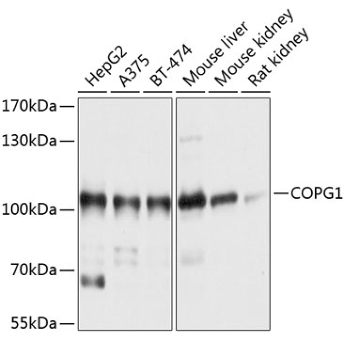 COPG1 Rabbit Polyclonal Antibody