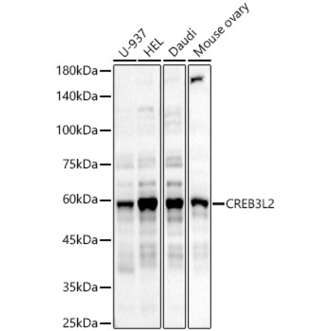 CREB3L2 Rabbit Polyclonal Antibody