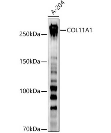 COL11A1 Rabbit Polyclonal Antibody