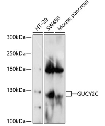 GUCY2C Rabbit Polyclonal Antibody
