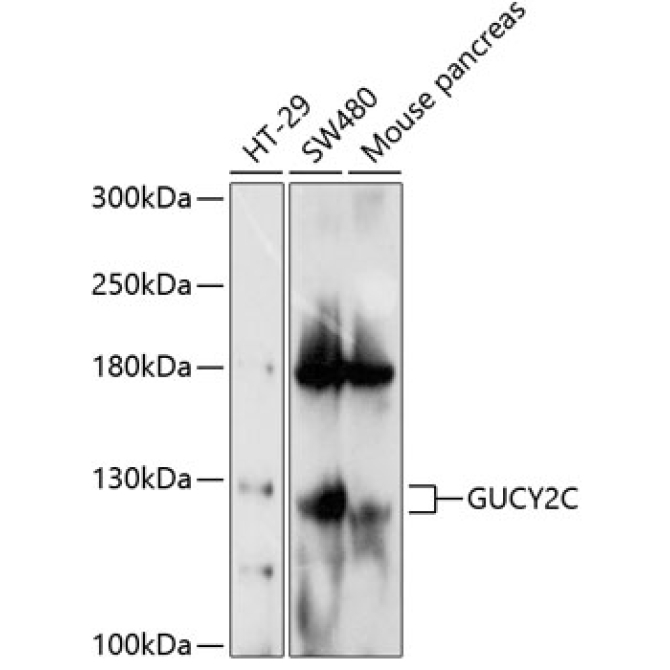 GUCY2C Rabbit Polyclonal Antibody