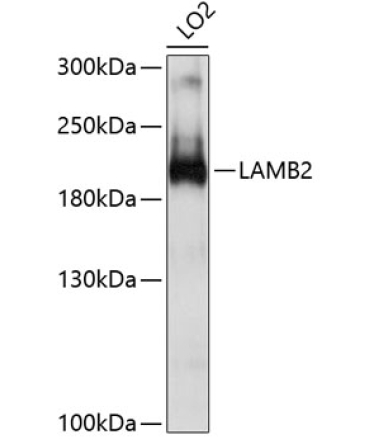 LAMB2 Rabbit Polyclonal Antibody