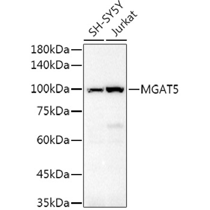 GNT-V/MGAT5 Rabbit Polyclonal Antibody