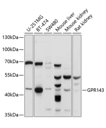 GPR143 Rabbit Polyclonal Antibody