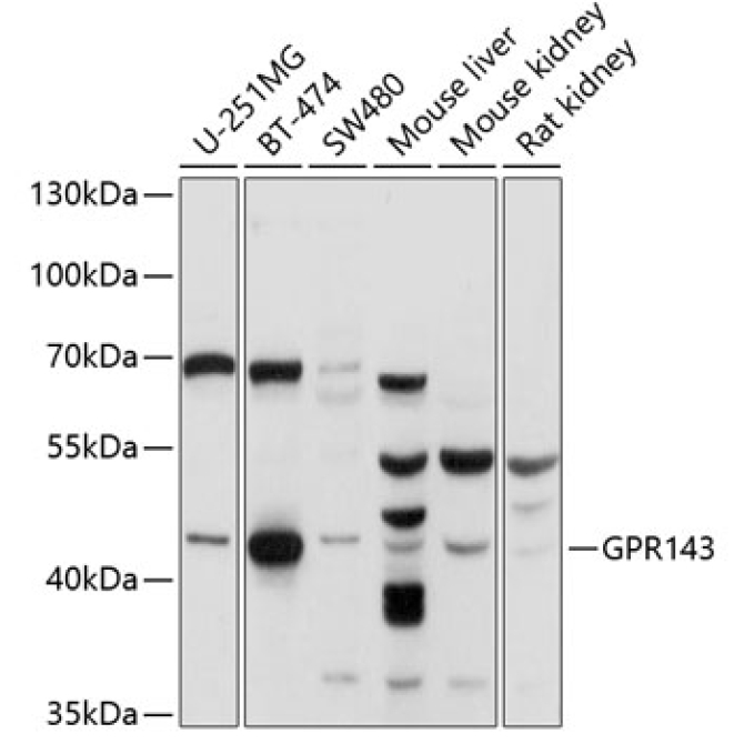 GPR143 Rabbit Polyclonal Antibody