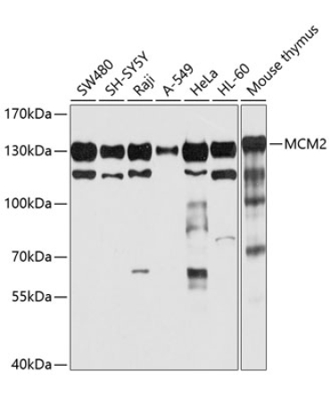 MCM2 Rabbit Polyclonal Antibody