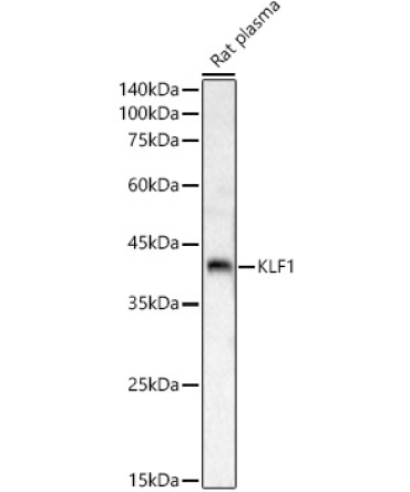 KLF1 Rabbit Polyclonal Antibody