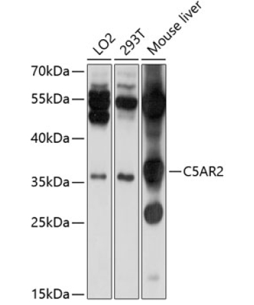 C5AR2 Rabbit Polyclonal Antibody