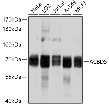 ACBD5 Rabbit Polyclonal Antibody