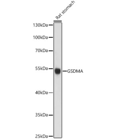 Gsdma Rabbit Polyclonal Antibody