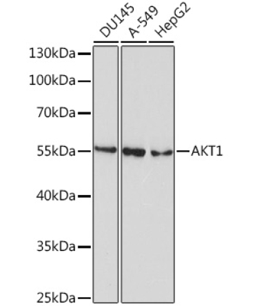 AKT1 Mouse Monoclonal Antibody