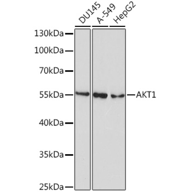 AKT1 Mouse Monoclonal Antibody