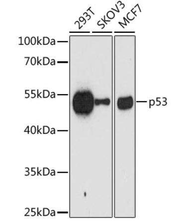 p53 Mouse Monoclonal Antibody