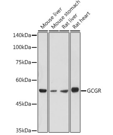 GCGR Rabbit Polyclonal Antibody