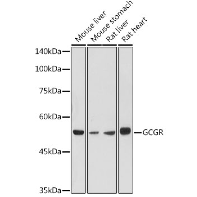 GCGR Rabbit Polyclonal Antibody