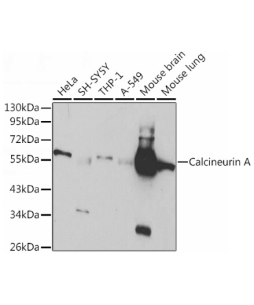 Calcineurin A Rabbit Polyclonal Antibody