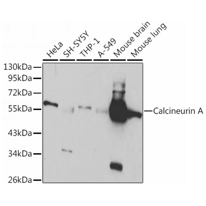 Calcineurin A Rabbit Polyclonal Antibody