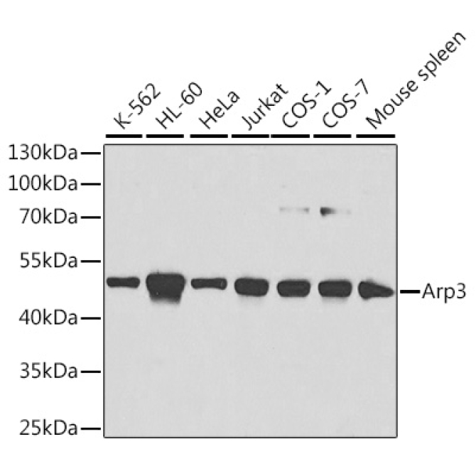 Arp3 Rabbit Polyclonal Antibody