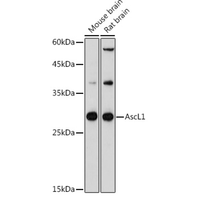 AscL1 Rabbit Polyclonal Antibody