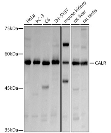 Calreticulin Rabbit Polyclonal Antibody