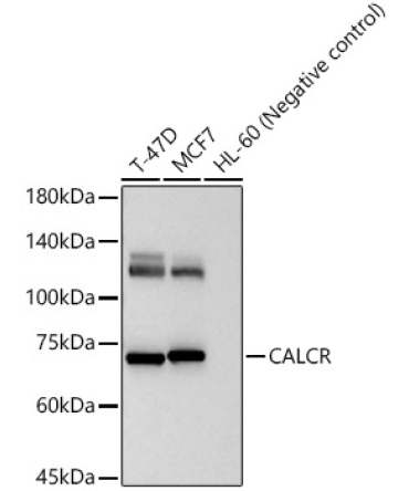 CALCR Rabbit Polyclonal Antibody