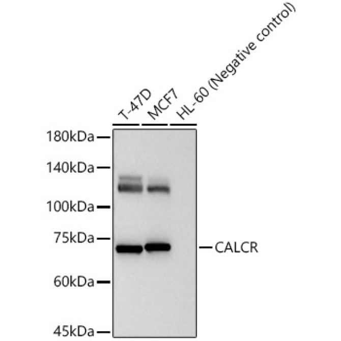 CALCR Rabbit Polyclonal Antibody