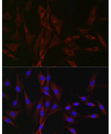 CACNA1H Rabbit Polyclonal Antibody