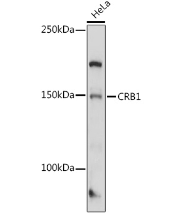 CRB1 Rabbit Polyclonal Antibody