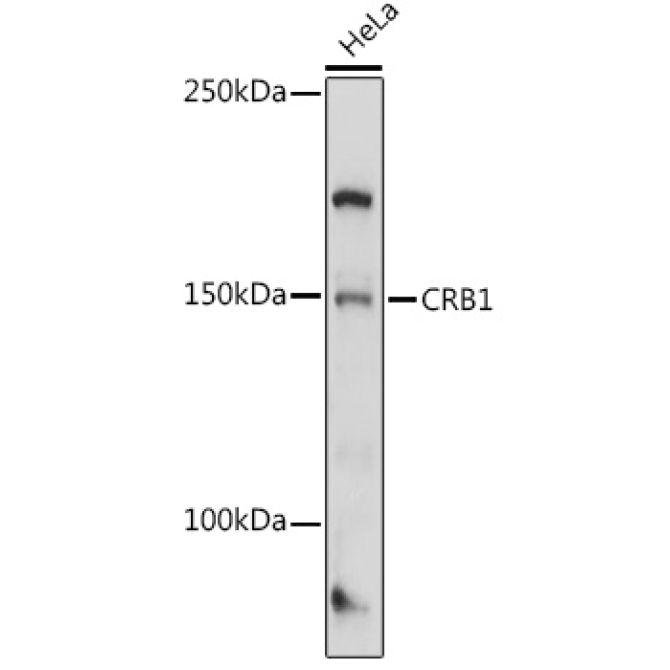 CRB1 Rabbit Polyclonal Antibody
