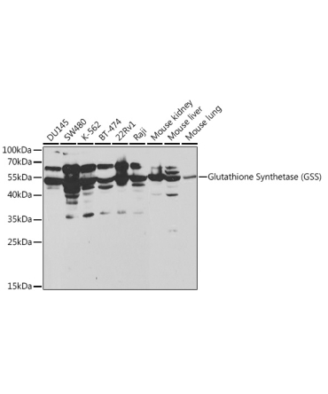 Glutathione Synthetase (GSS) Rabbit Polyclonal Antibody