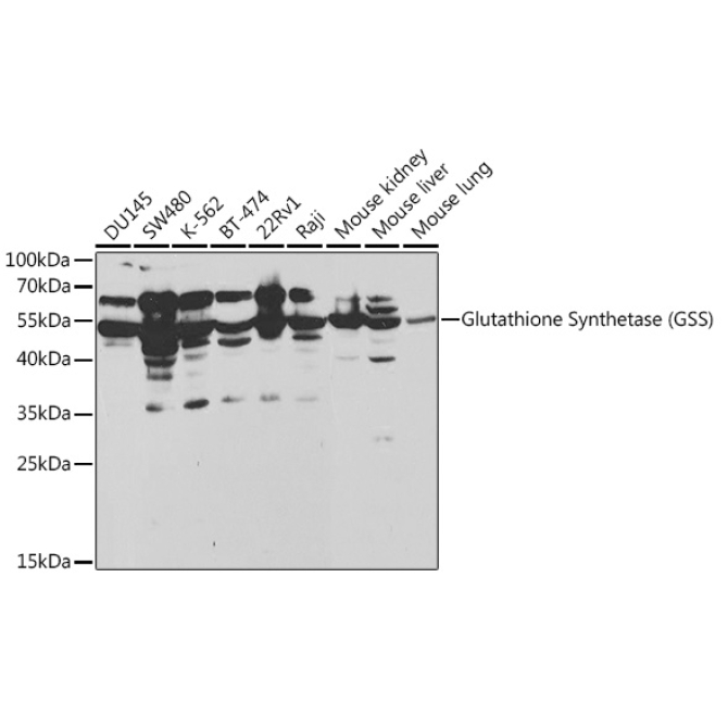 Glutathione Synthetase (GSS) Rabbit Polyclonal Antibody