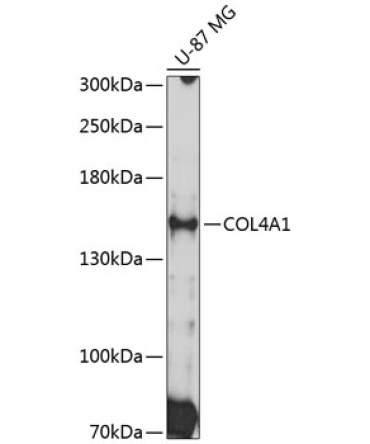 COL4A1 Rabbit Polyclonal Antibody
