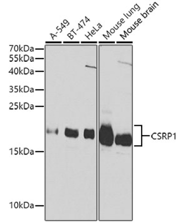 CSRP1 Rabbit Polyclonal Antibody