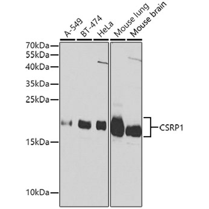 CSRP1 Rabbit Polyclonal Antibody