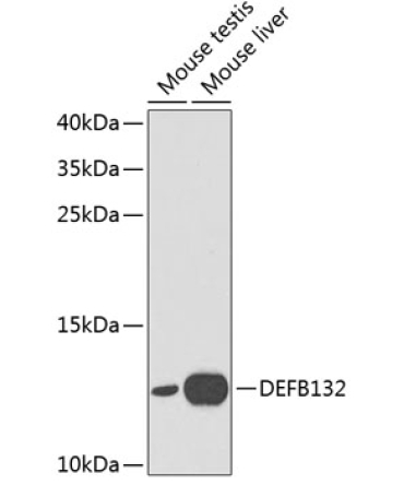 DEFB132 Rabbit Polyclonal Antibody