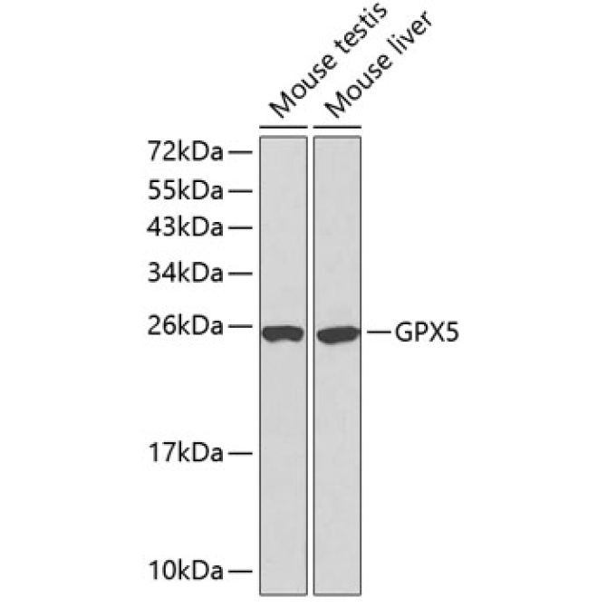 GPX5 Rabbit Polyclonal Antibody