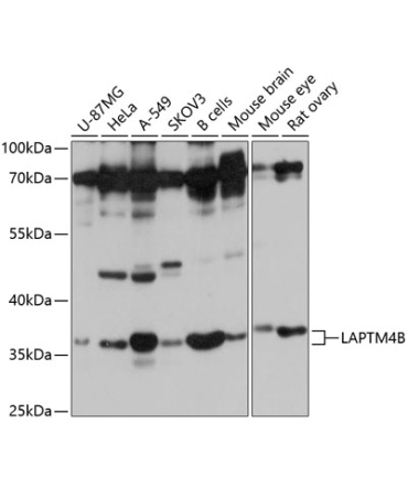 LAPTM4B Rabbit Polyclonal Antibody