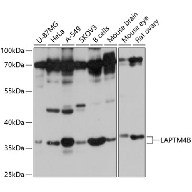 LAPTM4B Rabbit Polyclonal Antibody