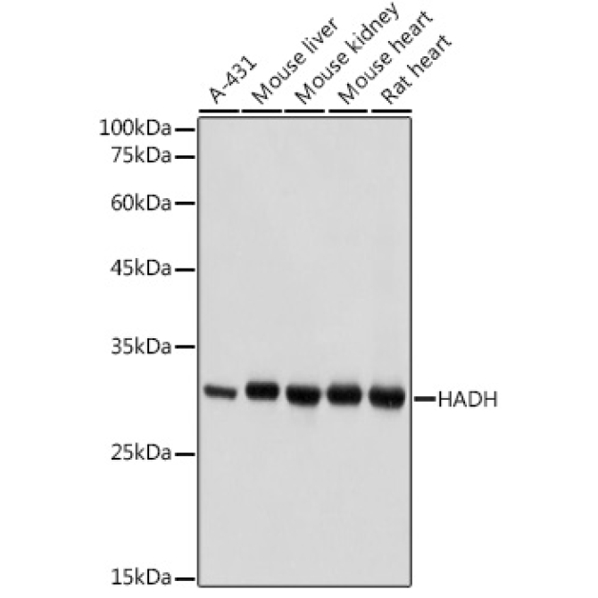 HADH Rabbit Polyclonal Antibody