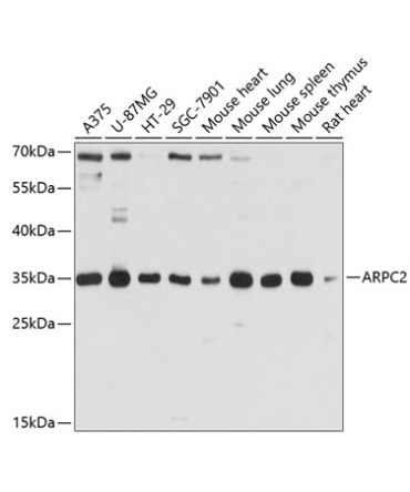ARPC2 Rabbit Polyclonal Antibody