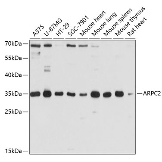 ARPC2 Rabbit Polyclonal Antibody