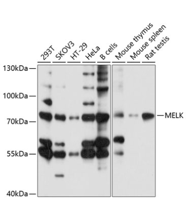 MELK Rabbit Polyclonal Antibody