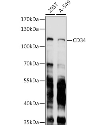 CD34 Mouse Monoclonal Antibody