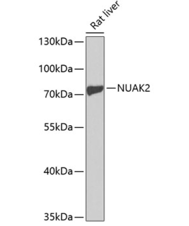 NUAK2 Rabbit Polyclonal Antibody