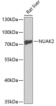 NUAK2 Rabbit Polyclonal Antibody